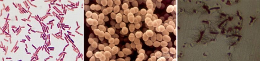 Escherichia coli, enterococco fecale e Proteus sono i principali agenti causali della prostatite batterica cronica