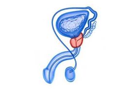 disegno dell'infiammazione della prostata