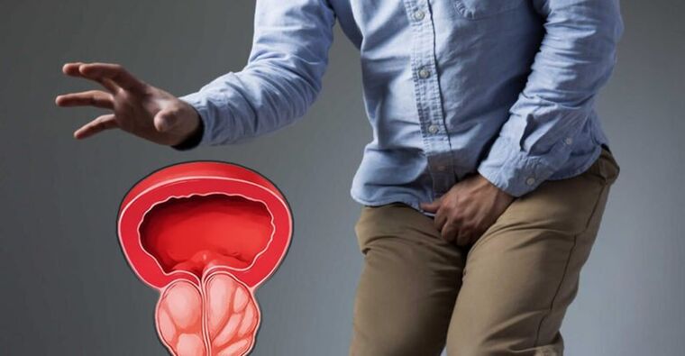 Prevenzione della prostatite e adenoma prostatico